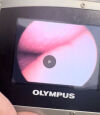 OLYMPUS MAF-GM Intubation Scope