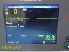 PHILIPS 2009  Intellivue X2 M3002A Ref 865039 Companion Monitor