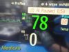 PHILIPS 2009  Intellivue X2 M3002A Ref 865039 Companion Monitor