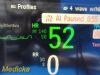 PHILIPS 2007  Intellivue X2 M3002A Companion , Ref 865039 W/O Leads ~ Monitor