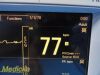 DATASCOPE 0998-00-0170-0014A Passport 2 Patient Monitor