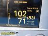 DATASCOPE 0998-00-0170-0014A Passport 2 Patient Monitor
