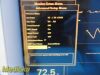 DATASCOPE 0998-00-0170-0014A Passport 2 Patient Monitor