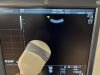 GE Voluson E6 Ultrasound - Shared Service