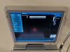 MINDRAY Z6 Ultrasound - Shared Service