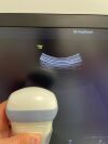 GE Voluson S10 Expert BT22 Ultrasound - OB / GYN