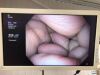OLYMPUS GIF-H190N Gastroscope