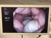 OLYMPUS GIF-H190N Gastroscope