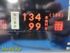 SPACELABS MEDICAL Spacelabs 91370 Ultraview, SL W/ 91496 Module, PSU & Leads ~  Patient Monitor