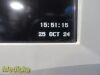 SPACELABS 91370 Ultraview SL, W/ Modules, NEW Leads & PSU ~ 35465 Monitor