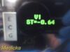 SPACELABS 91370 Ultraview SL, W/ Modules, NEW Leads & PSU ~ 35465 Monitor