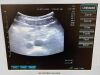 SIEMENS ACUSON Freestyle Ultrasound - OB / GYN - Vascular