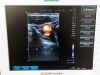 SIEMENS ACUSON Freestyle Ultrasound - OB / GYN - Vascular