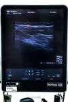 BK MEDICAL Flex Focus 800 USG