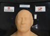 BLUE PHANTOM Full-Torso FAST Trauma Exam Ultrasound Training Model W/ Case - 193940 Training Aids