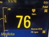 DATASCOPE Passport 2 Monochrome Patient  (Temp, NBP, SpO2, ECG) ~ Monitor