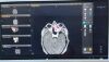 BRAINLAB Buzz-On Wall Monitor