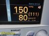 DATASCOPE 0998-00-0900-5014A Passport 2 Coloured Patient Monitor