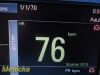 DATASCOPE 0998-00-0900-5014A Passport 2 Coloured Patient Monitor