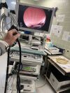 FUJINON EG530UT2 Gastroscope