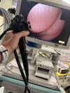 FUJINON EG-530UR2 Gastroscope