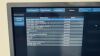 PHILIPS IE33 Cart G.1 5 Probes included YOM: 2011 Ultrasound - Cardiac - Vascular