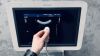 PHILIPS IE33 Cart G.1 5 Probes included YOM: 2011 Ultrasound - Cardiac - Vascular