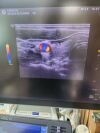 GE Logic S8 Ultrasound - Cardiac - Vascular