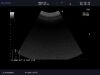ALOKA UST-9115 Ultrasound Transducer
