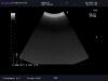 ALOKA UST-9126 Ultrasound Transducer
