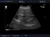 ALOKA UST-9126 Ultrasound Transducer