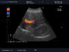 ALOKA UST-9126 Ultrasound Transducer