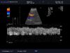 ALOKA UST-9126 Ultrasound Transducer