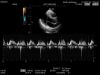 HITACHI EUP-S50A Ultrasound Transducer