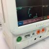 FUKUDA DENSHI DS-7200 Bedside Monitor