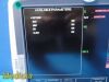 GE 2010  Dash 5000, (NBP, IBP, ECG, SpO2, Temp) *FOR PART: S* Monitor