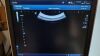 TOSHIBA PVT-375BT Ultrasound Transducer