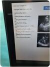 IMACOR ZT-1000 HEMODYNAMIC ULTRASOUND SYSTEM %