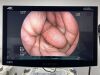 FUJINON EC-600WM Scope Endoscope