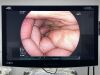 FUJINON EC-600WM Scope Endoscope