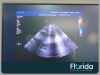 PHILIPS S5-1 CARDIAC TRANSDUCER PROBE  REF 453561176741 TESTED ** 30 DAYS WARRANTY Ultrasound Transducer