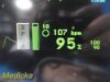 SPACELABS 91370 Ultraview SL Patient Monitor