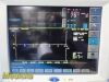 SPACELABS 91370 Ultraview SL,W/ 91496 Module, PSU & Leads ~ Patient Monitor