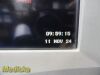 SPACELABS 91370 Ultraview SL,W/ 91496 Module, PSU & Leads ~ Patient Monitor