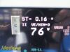SPACELABS 91370 Ultraview SL,W/ 91496 Module, PSU & Leads ~ Patient Monitor