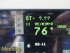SPACELABS 91370 Ultraview SL Patient Monitor