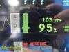 SPACELABS 91370 Ultraview SL Patient Monitor
