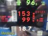 SPACELABS 91370 Ultraview SL Patient Monitor