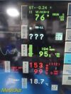 SPACELABS 91370 Ultraview SL Patient Monitor