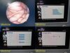 STRYKER ENDOSCOPY Stryker 26" Vision Elect HDTV ,Ref 240-030-960 W/ 240-030-950 PSU ~ Monitor